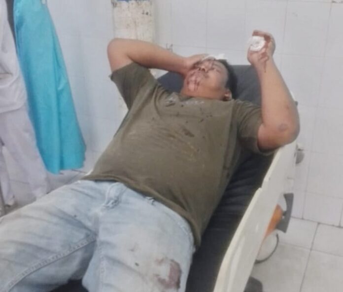 Warga yang mengaku sebagai ahli waris pemilik lahan seluas 366,06 hektare di Kabupaten Asahan mendapatkan perawatan medis usai diduga menjadi korban penganiayaan dalam bentrokan di area lahan eks HGU yang masih bersengketa.