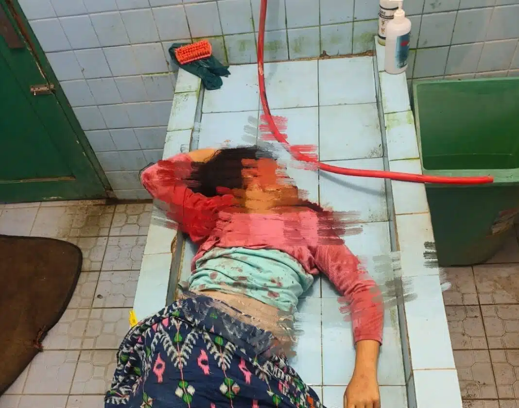 Salah satu korban kecelakaan beruntun di Sumbul, Sherwen Oktavia Sibagariang (12) saat berada di ruang jenazah RSUD Sidikalang, Minggu (21/6/2026). (Istimewa)
